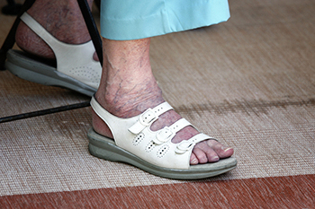 Footwear Plays a Role in Preventing Falls