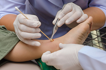 New Advances Helping Protect Diabetic Feet
